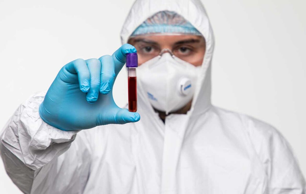 Entenda sobre o monitoramento da Covid-19