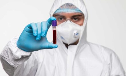 Entenda sobre o monitoramento da Covid-19