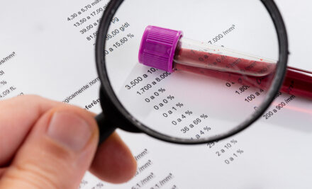 Para que serve o exame Hemograma?