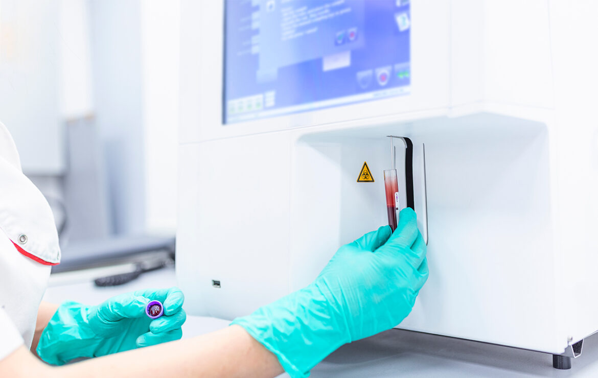 Saiba qual a finalidade do exame Hemograma!