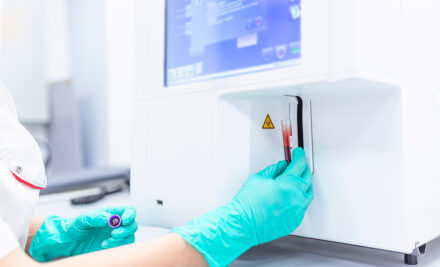 Saiba qual a finalidade do exame Hemograma!