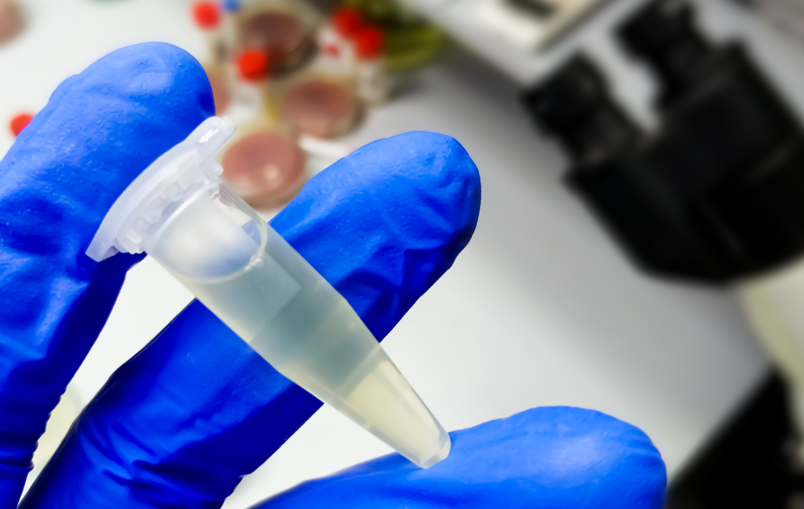 O exame que identifica o HPV e seus riscos: Captura híbrida de baixo e alto risco