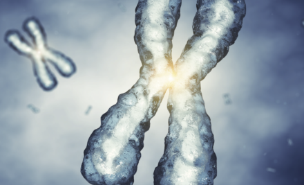 O que é a Síndrome do X frágil?